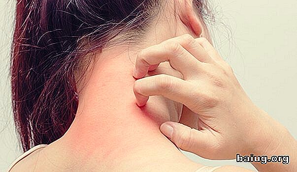 Atopisk dermatit och dess förhållande stress